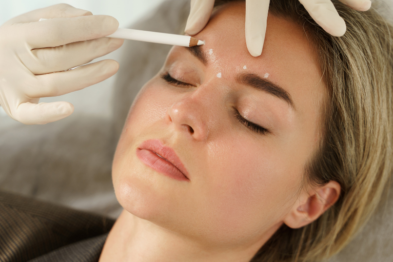 Vorher-Nachher-Vergleich Faltenbehandlung durch Botox.