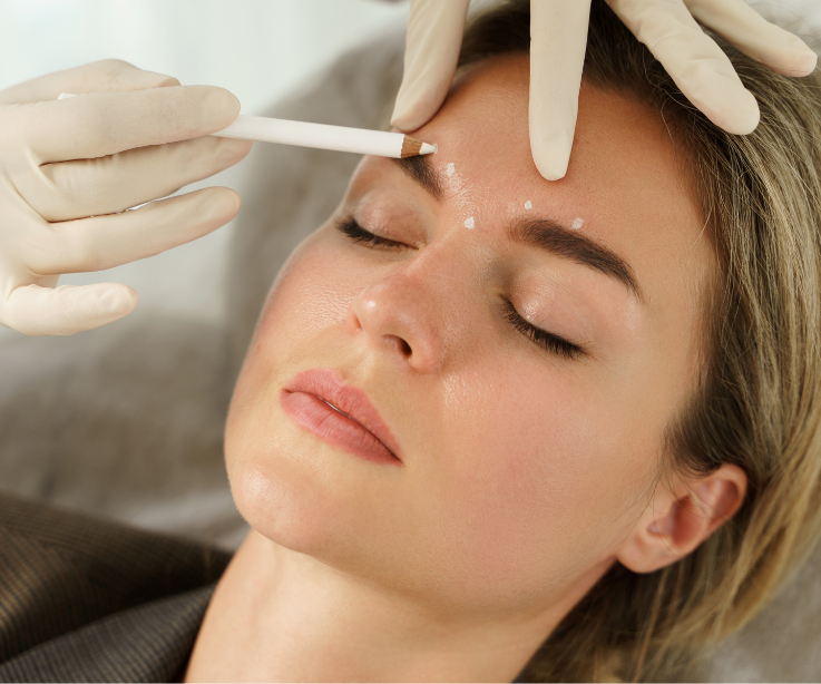 Eine Frau erhält eine Botox Gesichtsbehandlung mit einer feinen Kanüle.