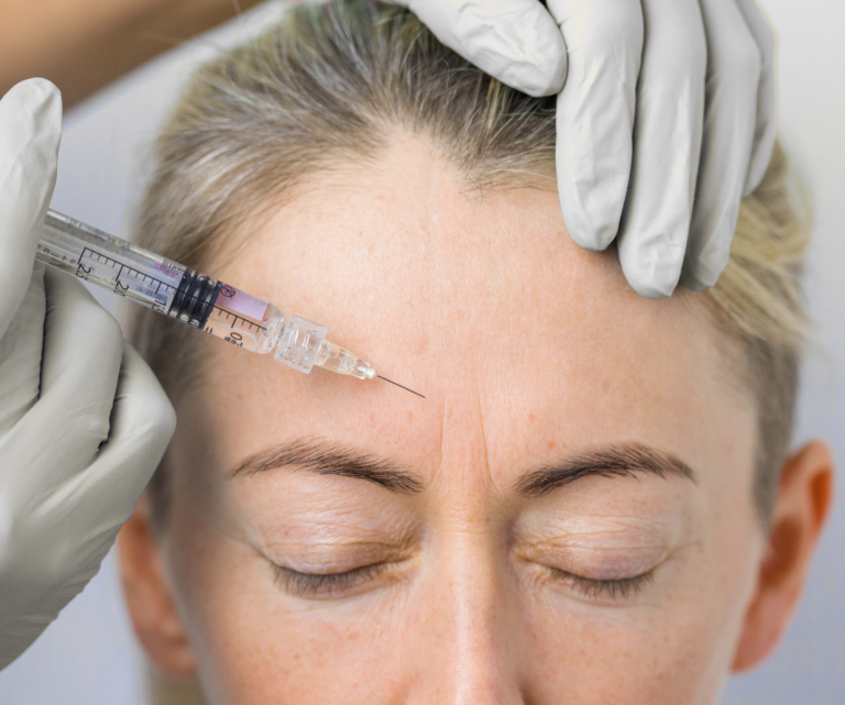 Patient erhält Botox Behandlung Eine Frau erhält eine Botox Gesichtsbehandlung mit einer feinen Kanüle.
